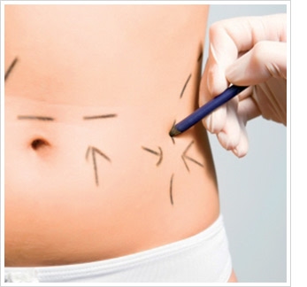 abdominal1